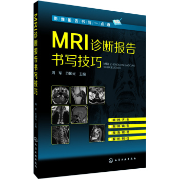 MRI\(bo)(sh)